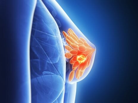 在今年的“意识月”活动中，记住乳腺癌的危害